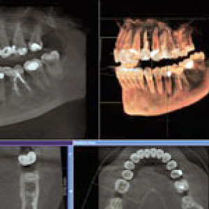 cone beam x ray view of the teeth and jaw